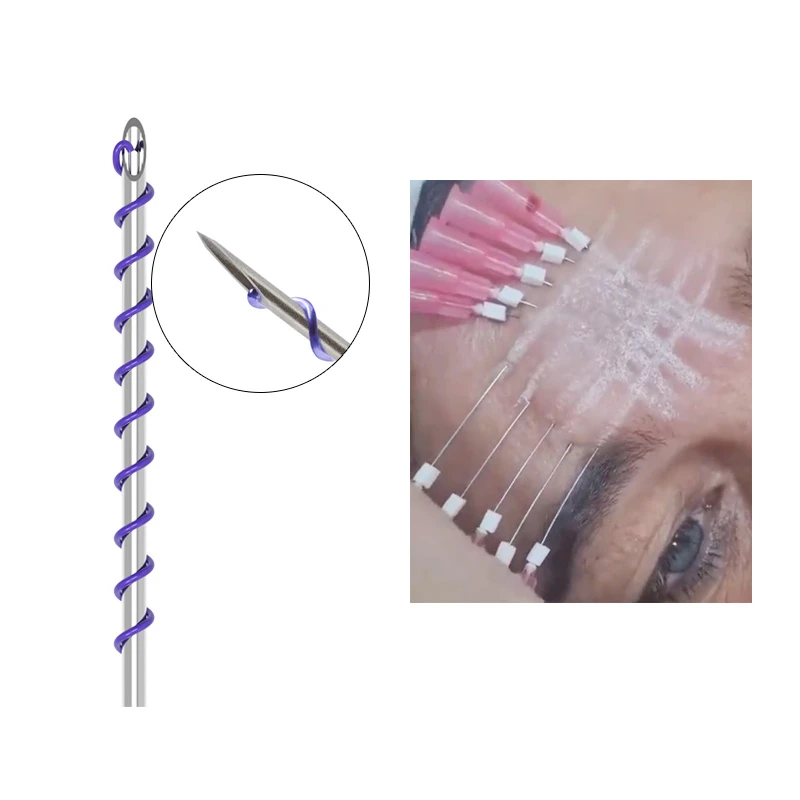 Mono Screw Thread