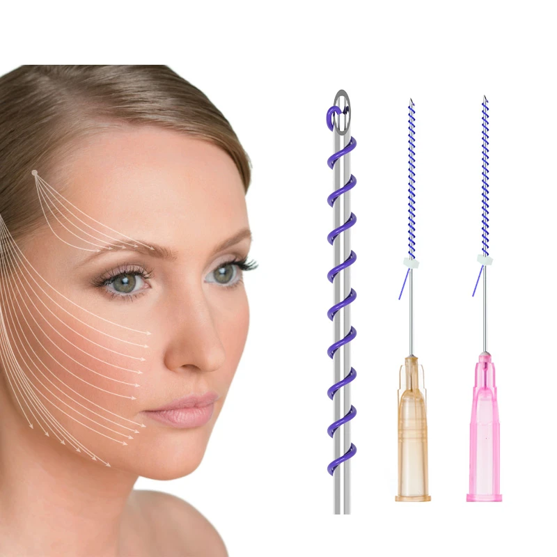 Mono Screw Thread