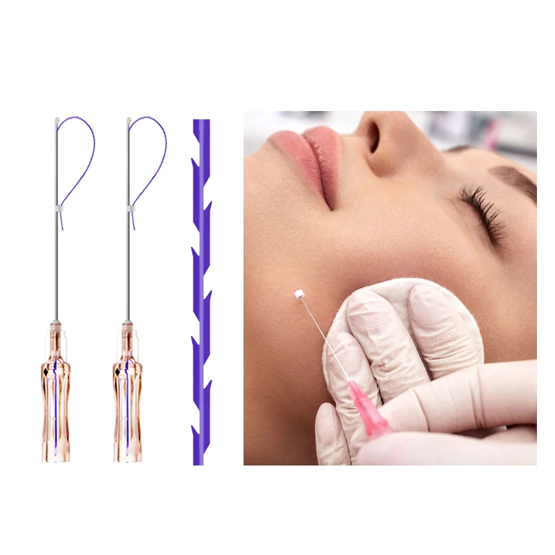 Molding Thread
