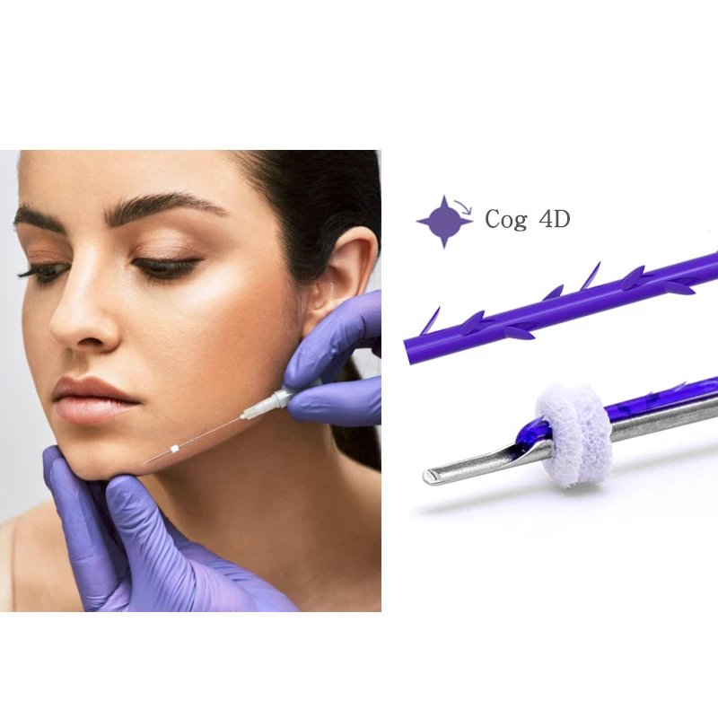 PDO Cog 4D Facial Lift: Advanced Thread Lifting for Jawline Contouring