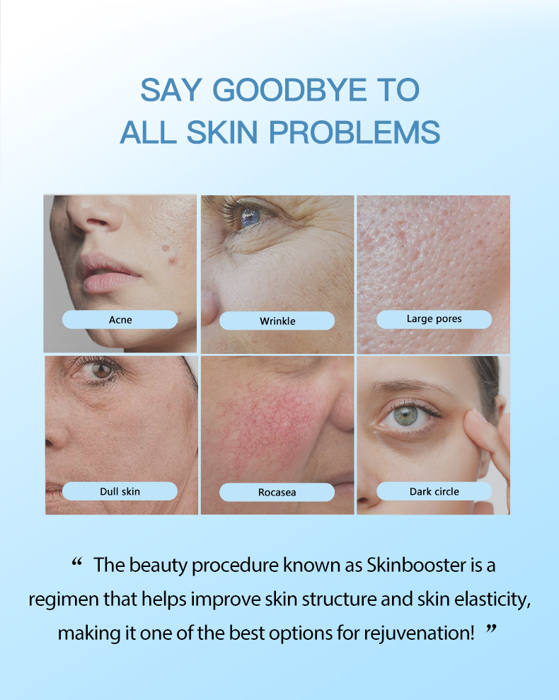 Meso Secret Skinbooster