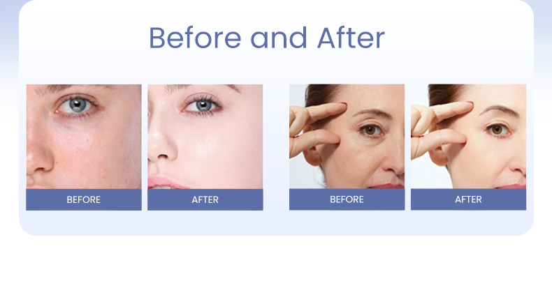 PDRN Skinbooster