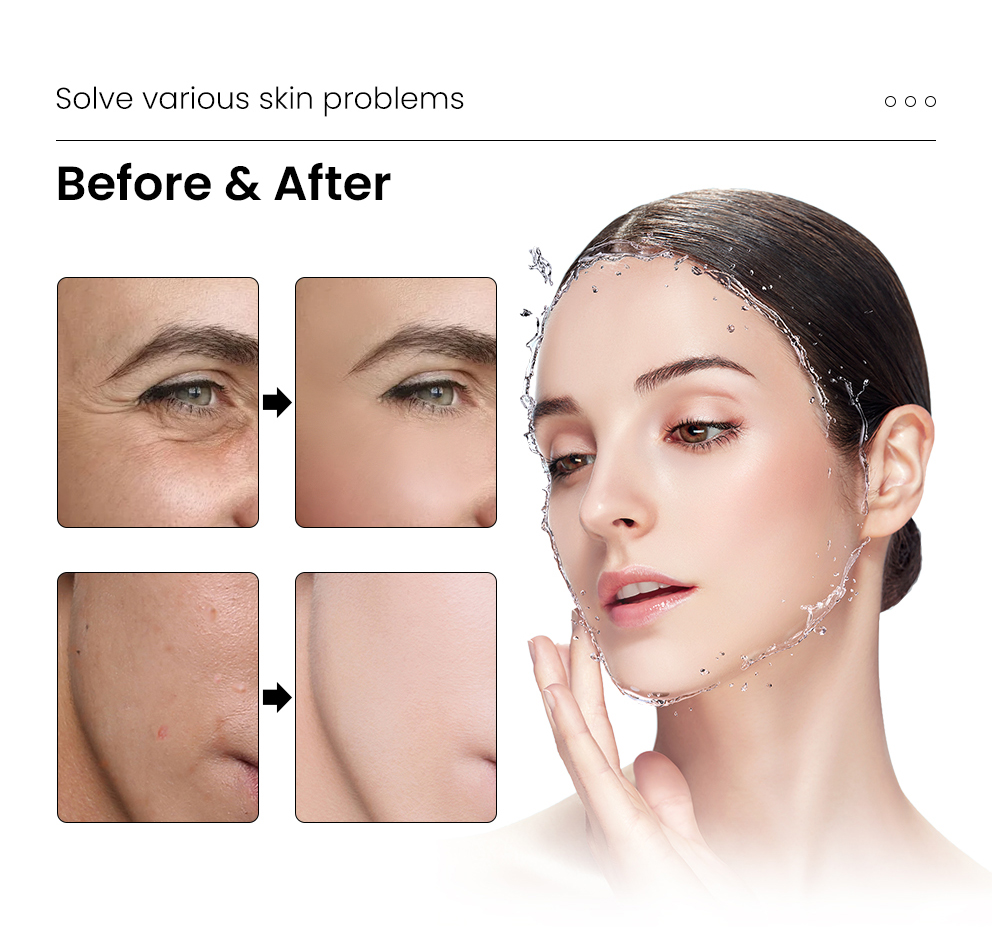 4D Hyaluronic Acid Skinbooster