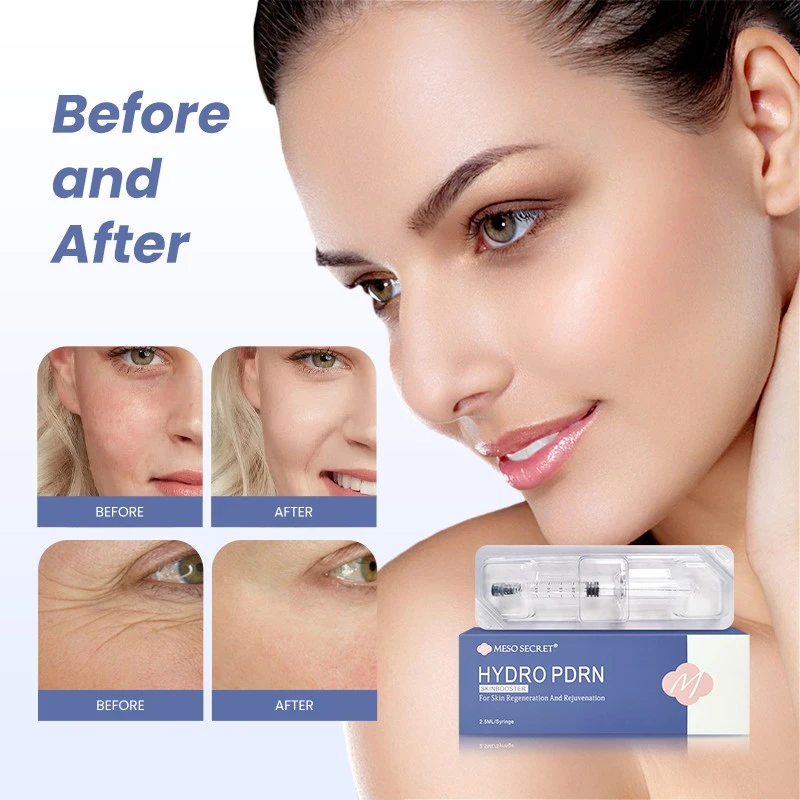 PDRN Skinbooster