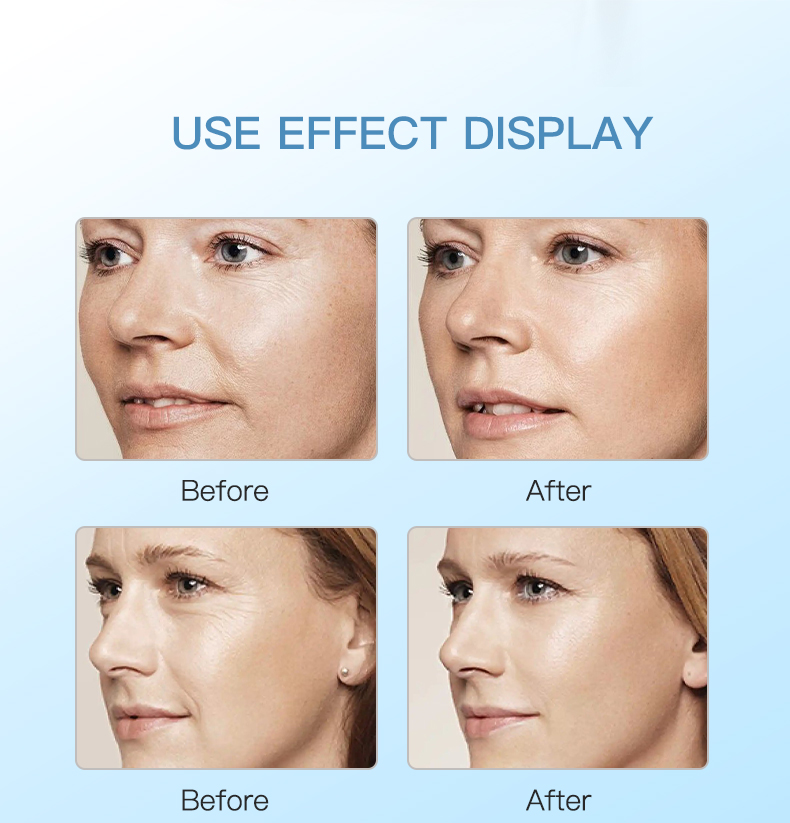 Meso Secret Skinbooster