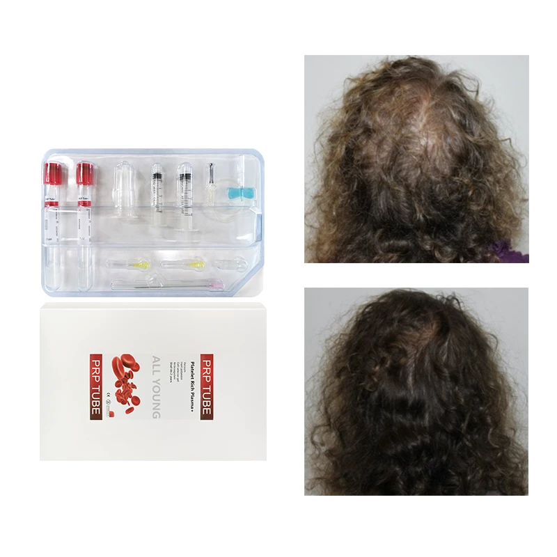 15ML PRP Tube Kit ACD GEL Korean Supplier