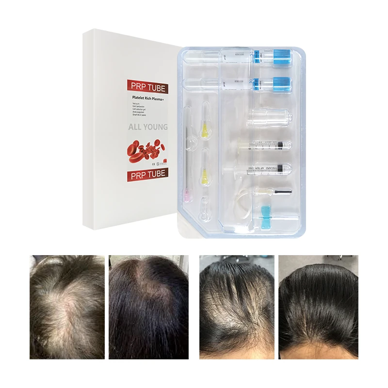 Korean 15ML ACD Gel Biotin PRP Tube Kit