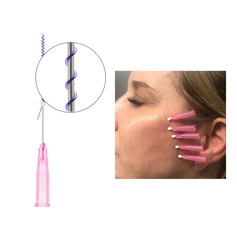 Mono Screw Thread
