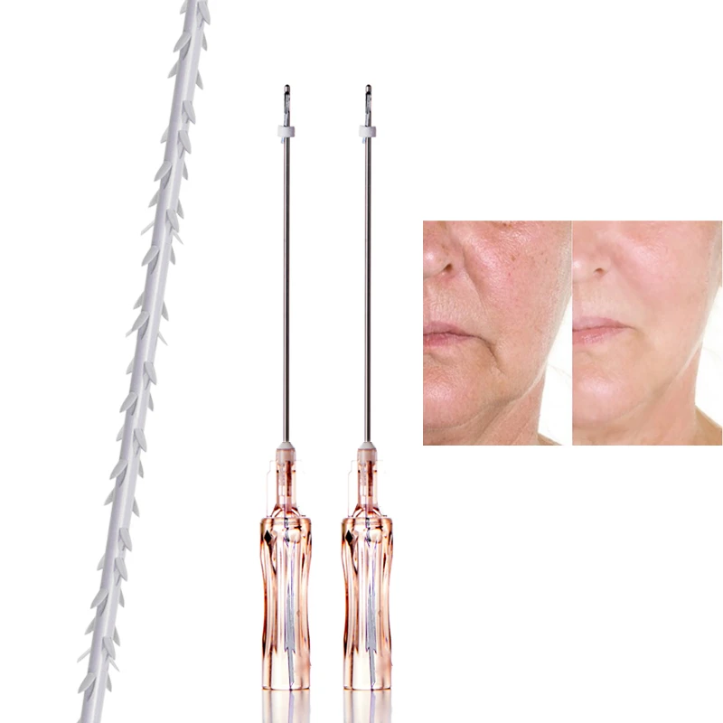 PLLA COG 6D Bidirectional Barbed Thread Max SMAS Lifting V-line Face Contour Premium Thread
