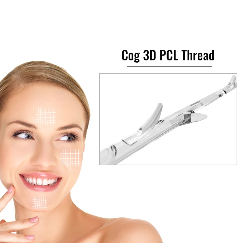 Absorable Cog 3D 19G 21G 23G PCL Threads