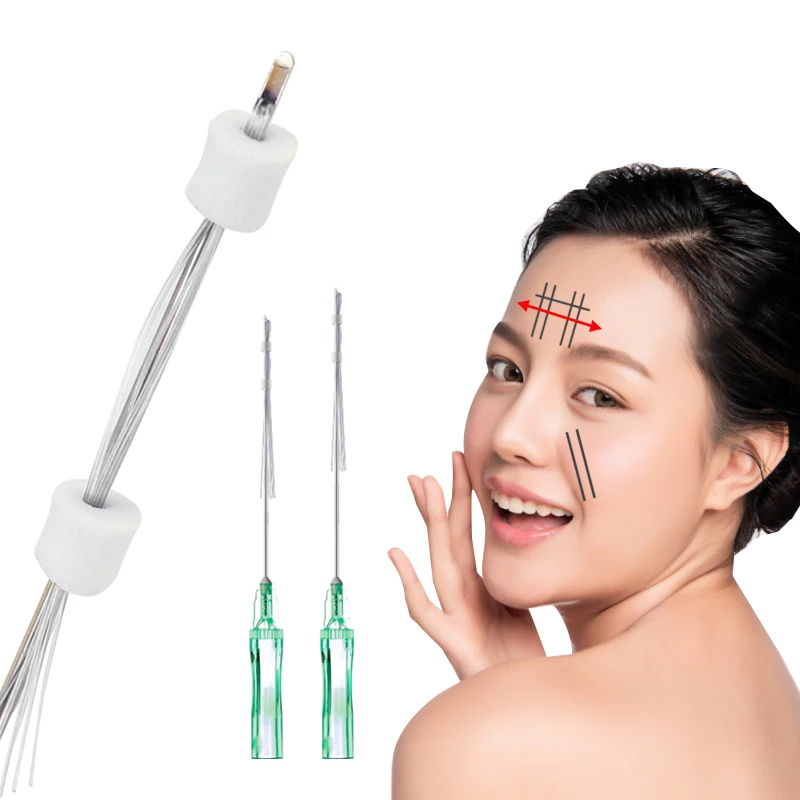 Medical Absorbable PCL Thread Multi Thread